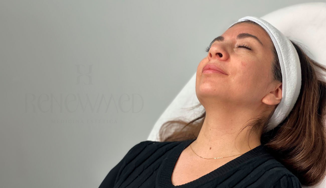 Mesoterapia Facial