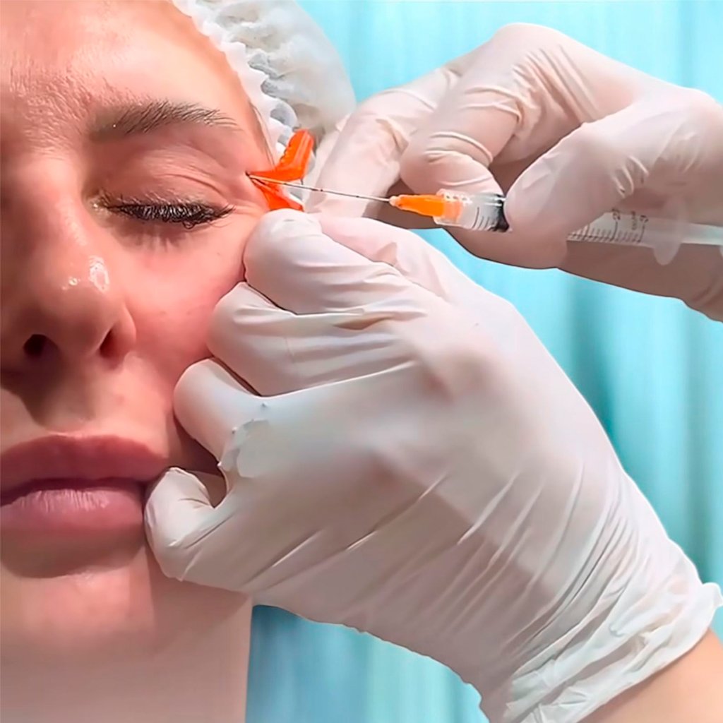 Nueva Cánula EasyGuide Renew - Image 3